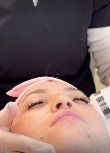 Atención facial: manos con guantes trabajando sobre el rostro